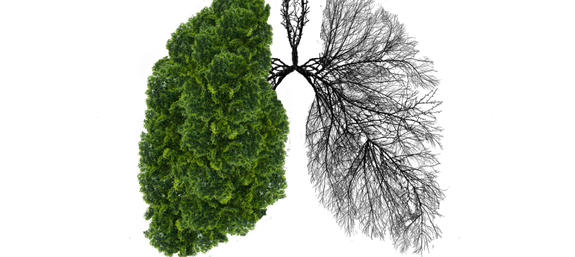 Russian Man Makes Medical History Tree Found Growing in His Lung